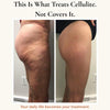 Bloom Anti-Cellulite Leggings