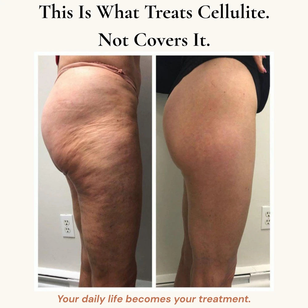 Bloom Anti-Cellulite Leggings