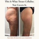 Bloom Anti-Cellulite Leggings