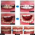 Teeth Whitening Toothpaste